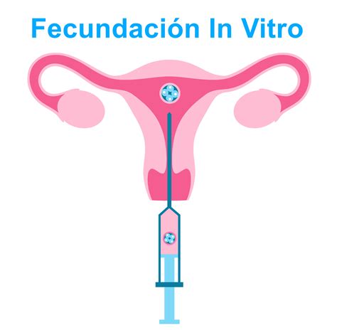 fecundación in vitro